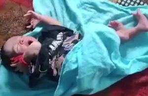 India Baby Born With 26 Fingers And Toes 