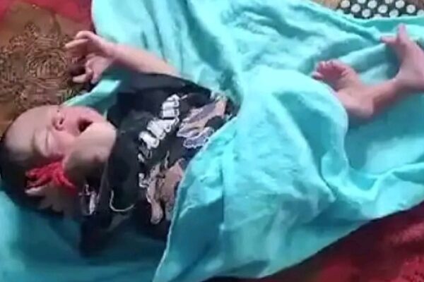 India Baby Born With 26 Fingers And Toes